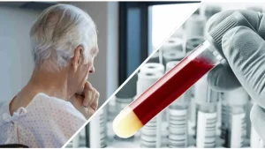 Analize de sânge pentru depistarea bolii Alzheimer: realizări care schimbă abordarea tratamentului acestei boli.