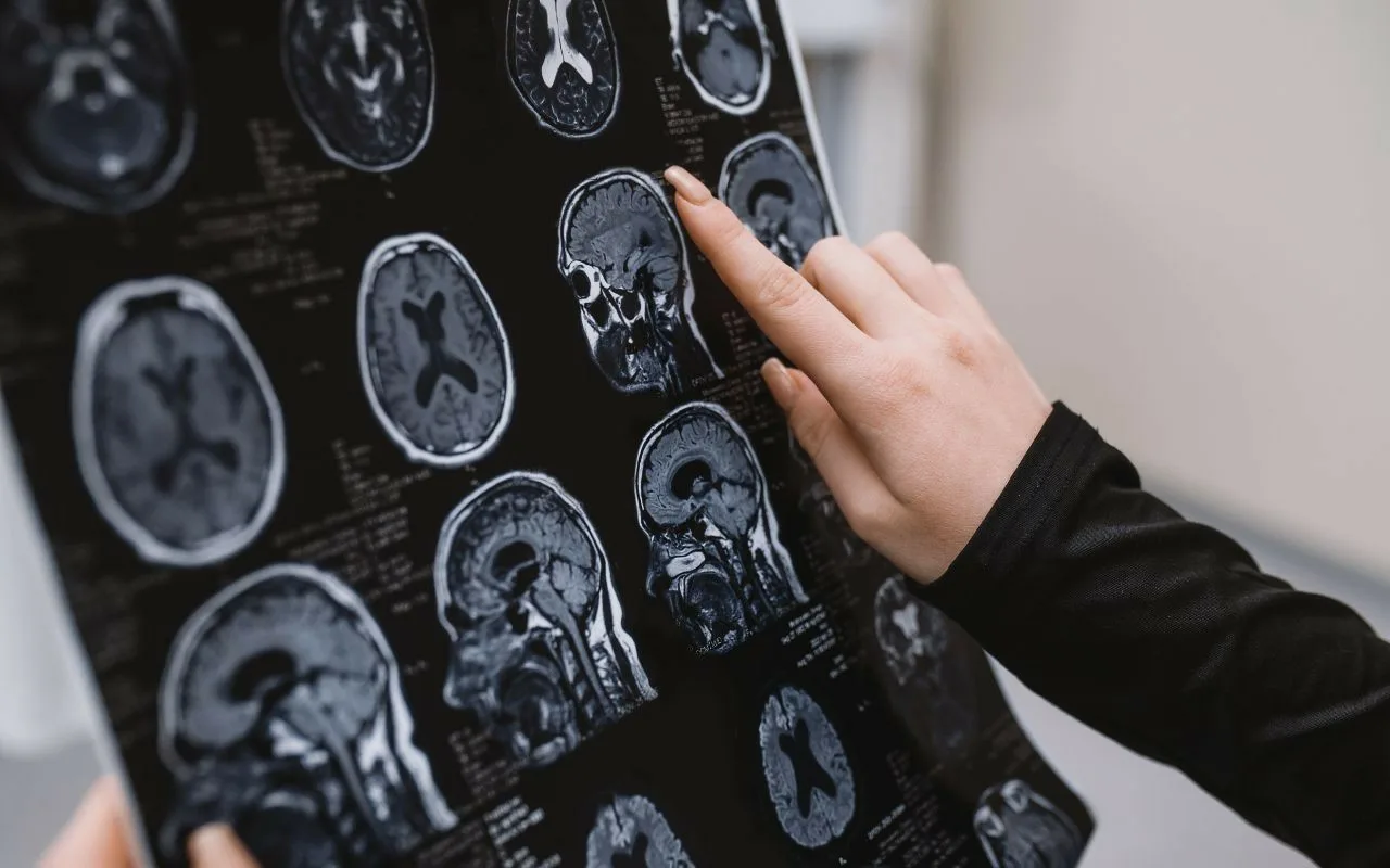 Experiențele traumatice cresc riscul de demență și accident vascular cerebral.